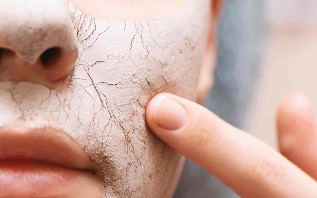 Sucha skóra? Oto naturalne sposoby na jej nawilżenie!
