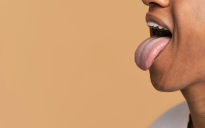 Pleśniawka na języku u dorosłych – przyczyny, objawy i leczenie