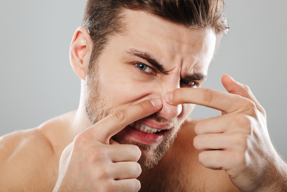 Wągry na nosie – jak się pozbyć?