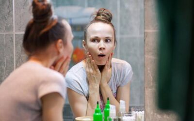 Jak dbać o twarz z trądzikiem na co dzień?