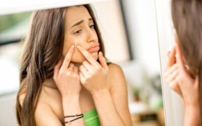 Jak walczyć z trądzikiem u dorosłych na co dzień?