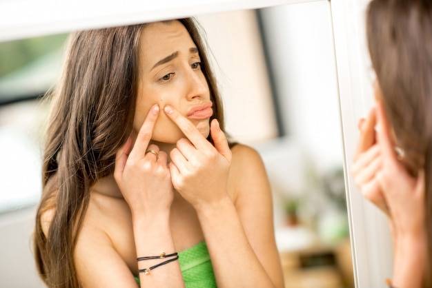 Jak walczyć z trądzikiem u dorosłych na co dzień?